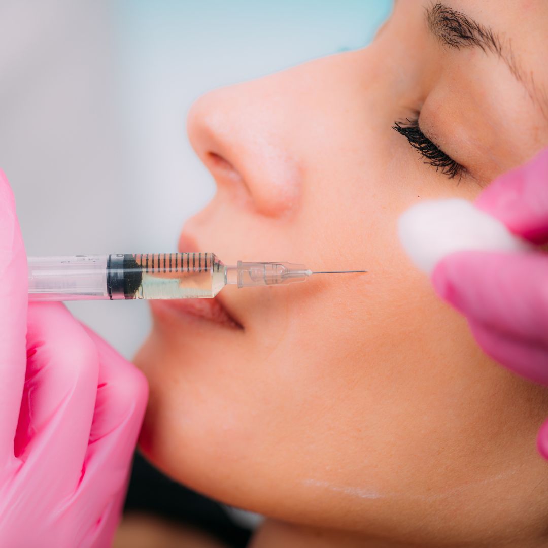 dermal fillers