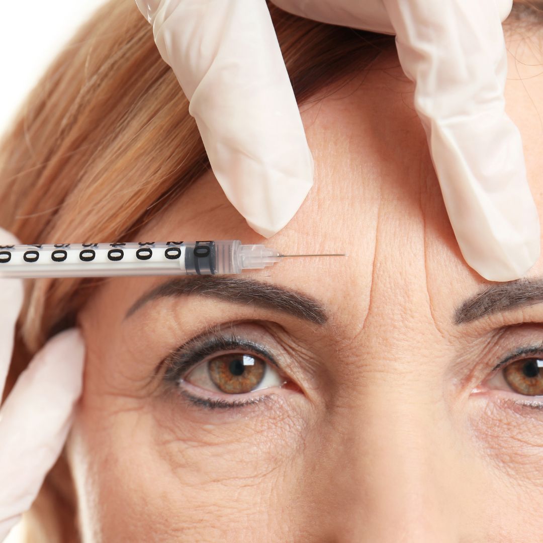 Woman with forehead wrinkles receiving dermal fillers