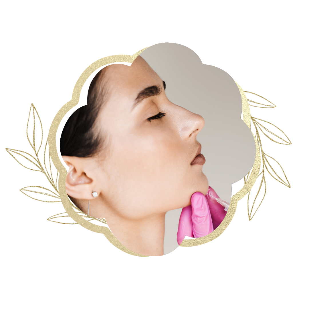 Juvederm 3