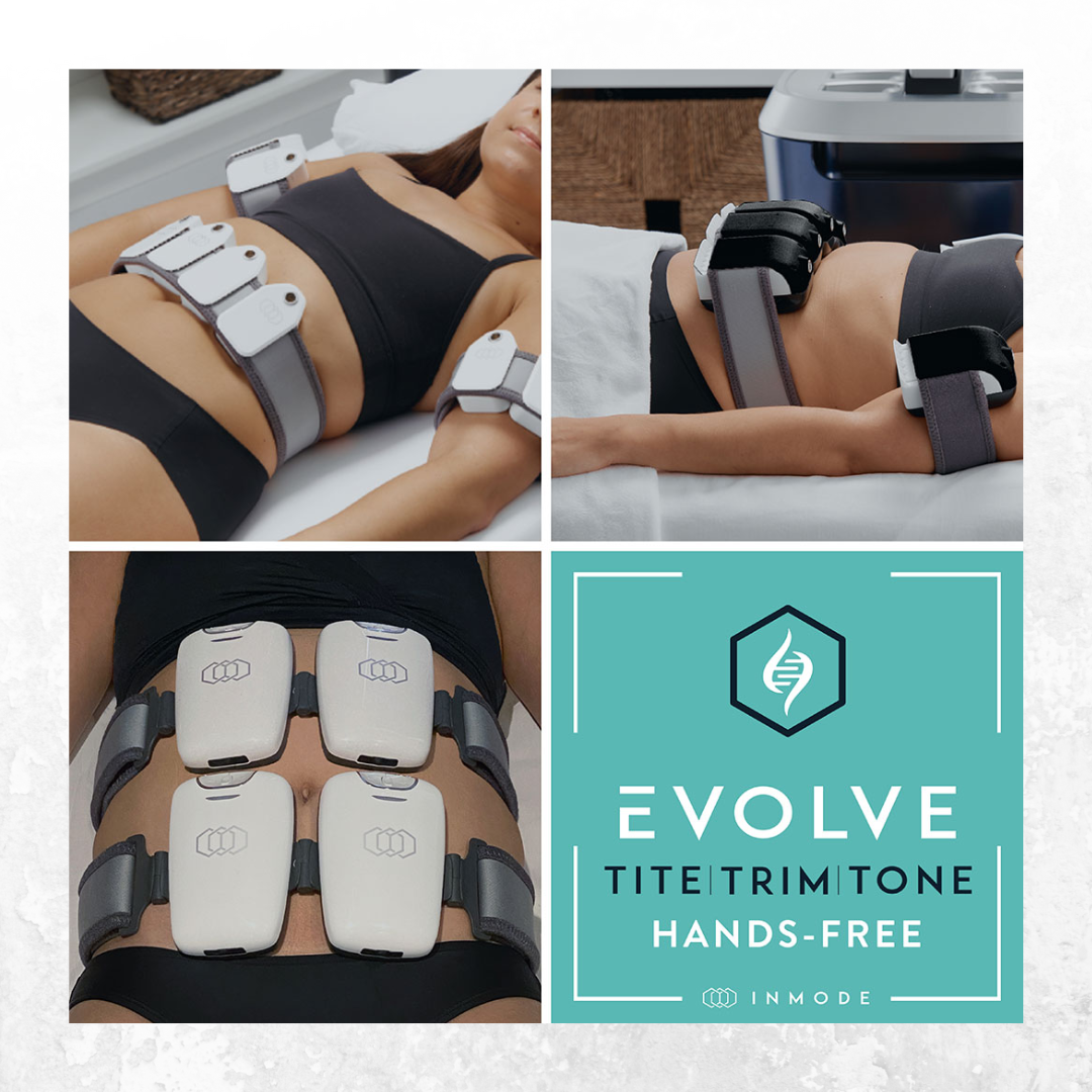 Evolve